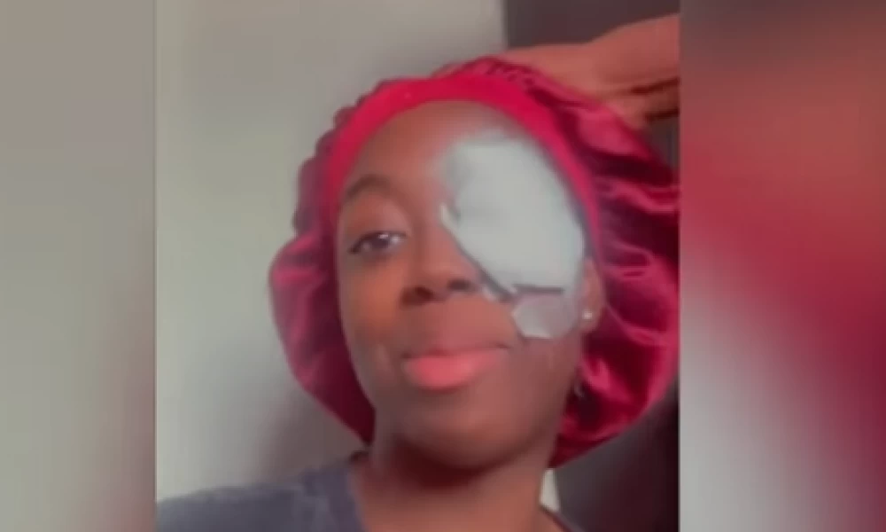 Έσκασε ο φορτιστής της και οι σπίθες την πέτυχαν στο μάτι